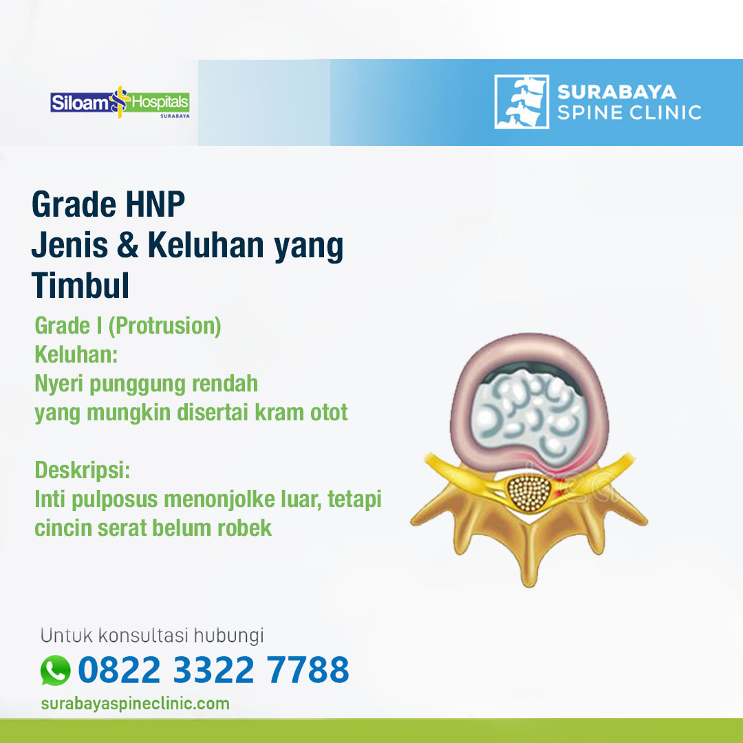 Grade HNP, Jenis & Keluhan yang Ditimbulkan 